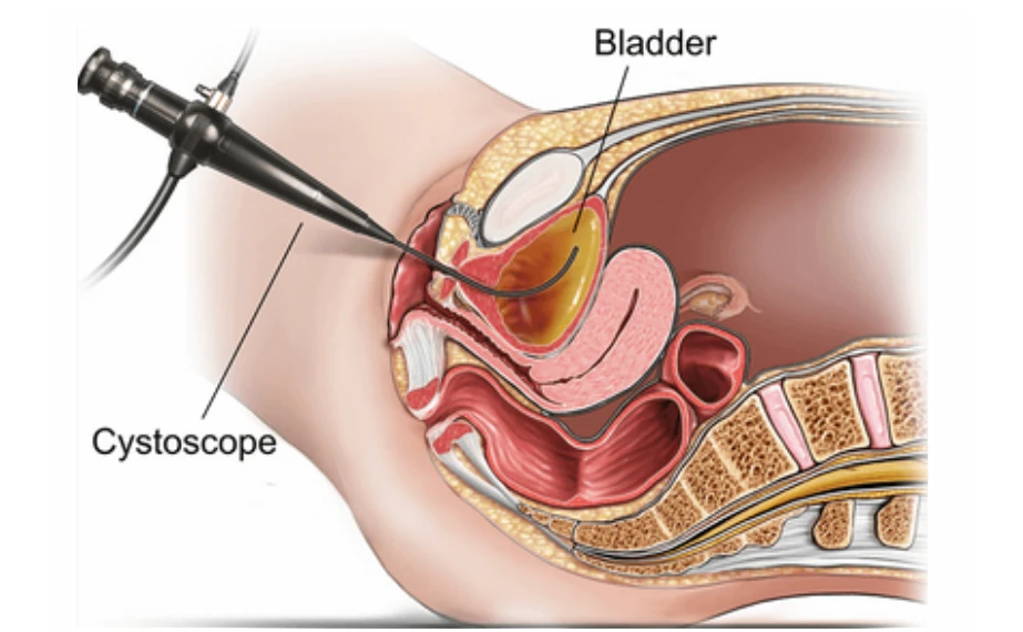 Melbourne Flexible Cystoscopy Urologist