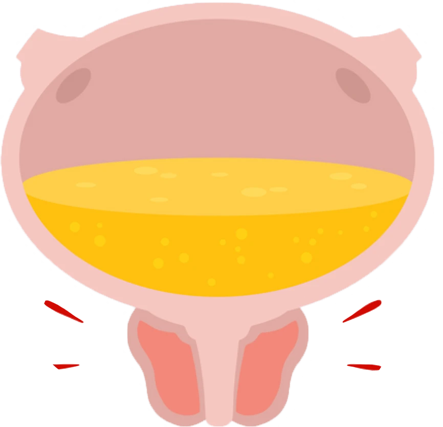 Melbourne Transperineal Template Prostate Biopsy