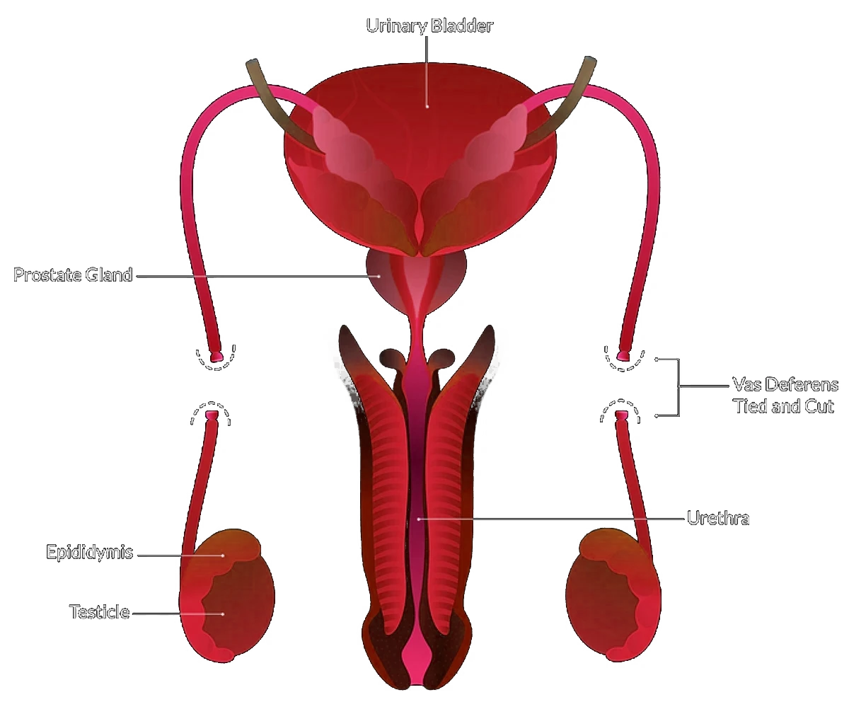 Melbourne Vasectomy Urologist
